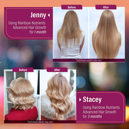 Hair Growth Vitamins for Women | Biotin 10,000mcg, Collagen, Patented OptiMSM®, goMCT®, Saw Palmetto | Naturally Regrow Stronger & Healthier Hair, Skin and Nails | Stops Hair Loss